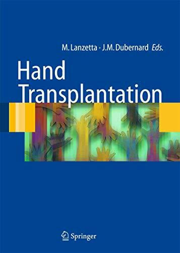 Hand transplantation (Ortopedia e chirurgia mininvasiva)