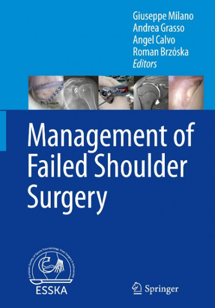 Management of Failed Shoulder Surgery