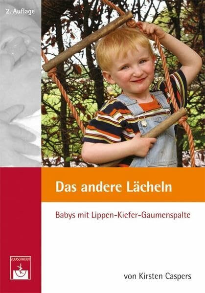 Das andere Lächeln: Babys mit Lippen-Kiefer-Gaumenspalte. Ein Buch (nicht nur) für Eltern
