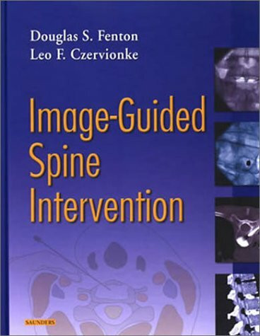 Image Guided Spine Interventional