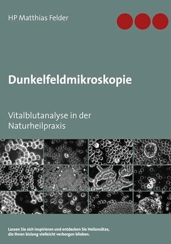 Dunkelfeldmikroskopie: Vitalblutanalyse in der Naturheilpraxis