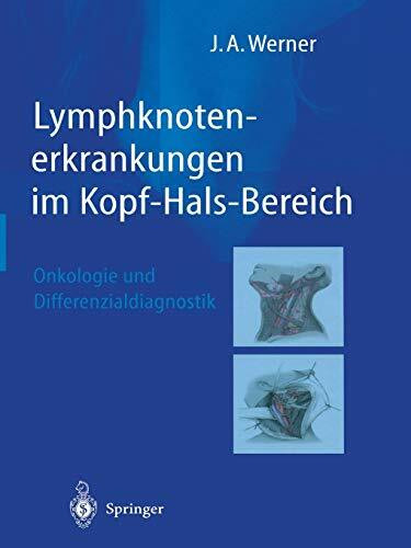 Lymphknotenerkrankungen im Kopf-Hals-Bereich: Onkologie Und Differenzialdiagnostik (German Edition)