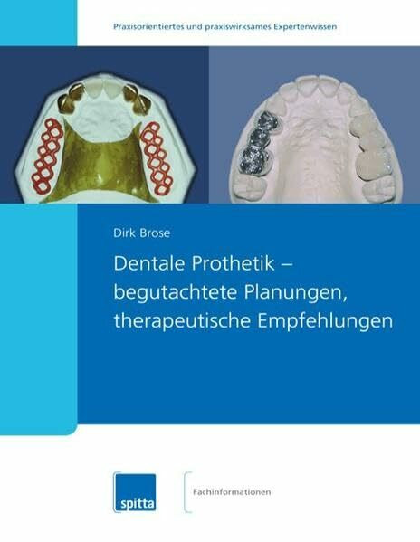 Dentale Prothetik – begutachtete Planungen, therapeutische Empfehlungen