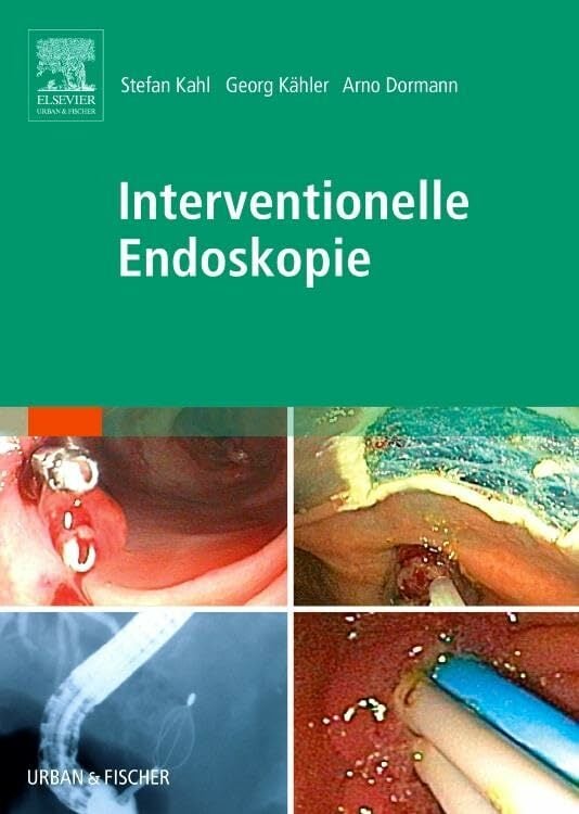 Interventionelle Endoskopie: Lehrbuch und Atlas Interventionelle Endoskopie: Lehrbuch und Atlas