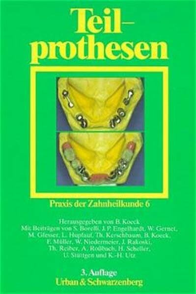 Praxis der Zahnheilkunde - PdZ. Strukturiert nach dem PermaNova-Verfahren: Praxis der Zahnheilkunde, 14 Bde. in 16 Tl.-Bdn., Bd.6, Teilprothesen