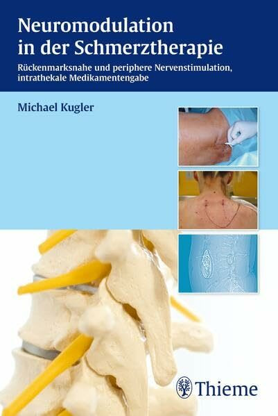 Neuromodulation in der Schmerztherapie: Epidurale und subkutane Nervenstimulation - Intrathekale Medikamentengabe: Rückenmarksnahe und periphere Nervenstimulation, intrathekale Medikamentengabe