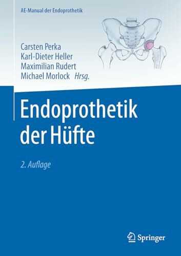 Endoprothetik der Hüfte (AE-Manual der Endoprothetik)