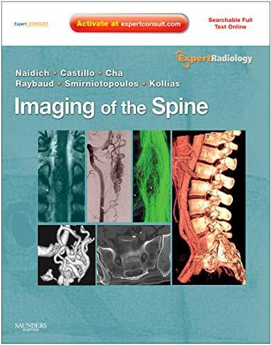 Imaging of the Spine (Expert Radiology)