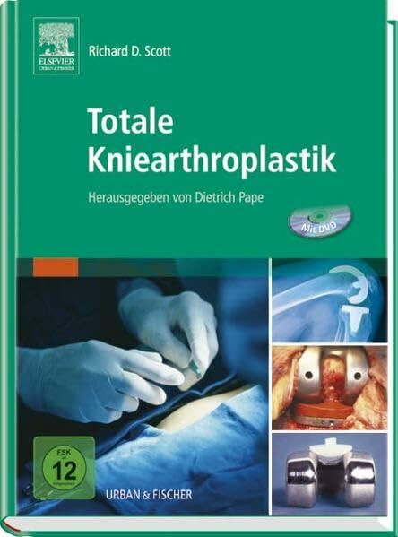 Totale Kniearthroplastik: Herausgegeben von Dietrich Pape