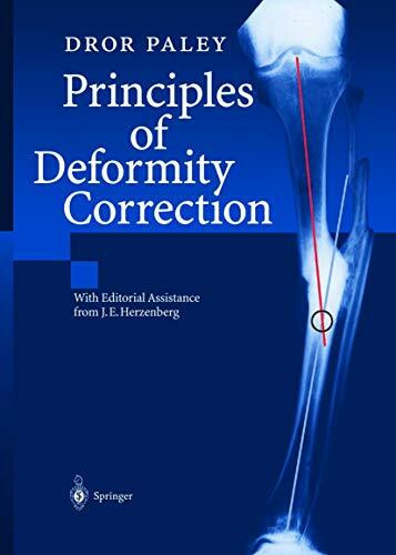 Principles of Deformity Correction