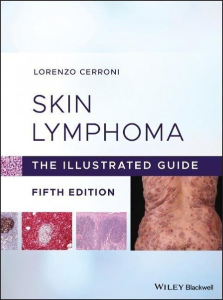 Skin Lymphoma - The Illustrated Guide