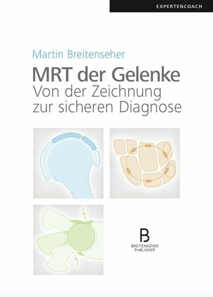 MRT der Gelenke: Von der Zeichnung zur sicheren Diagnose