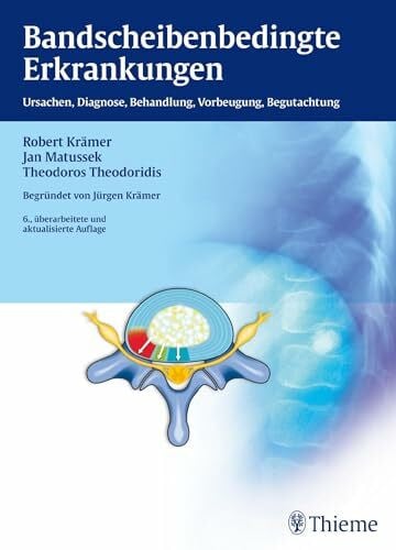 Bandscheibenbedingte Erkrankungen: Ursachen, Diagnose, Behandlung, Vorbeugung, Begutachtung