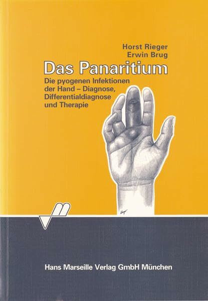 Das Panaritium: Die pyogenen Infektionen der Hand - Diagnose, Differentialdiagnose und Therapie