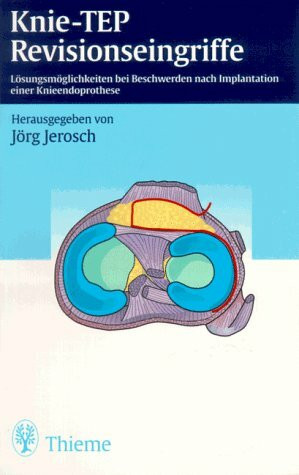 Knie-TEP Revisionseingriffe
