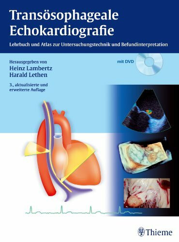 Transösophageale Echokardiografie: Lehrbuch und Atlas zur Untersuchungstechnik und Befundinterpretation