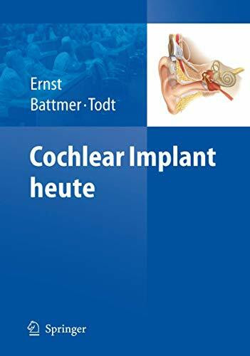 Cochlear Implant heute (German Edition)