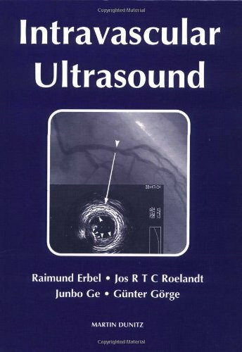 Intravascular Ultrasound