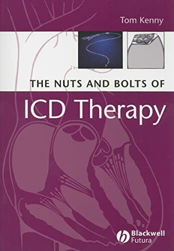 The Nuts and Bolts of ICD Therapy (Nuts and Bolts Series (Replaced by 5113))