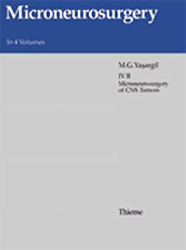 Microneurosurgery, 4 Vols., Vol.3B, AVM of the Brain, Clinical Considerations, General and Special Operative Techniques: AVM of the Brain, History, ... Diagnostic Studies, Microsurgical Anatomy