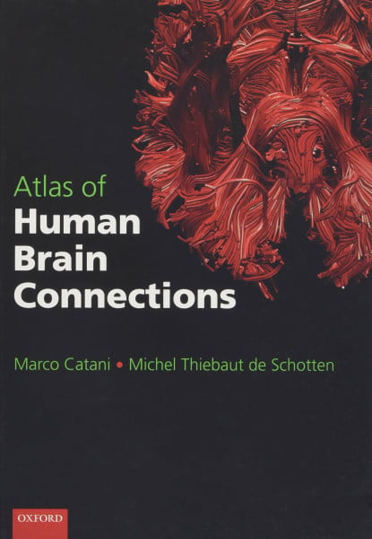 Atlas of Human Brain Connections