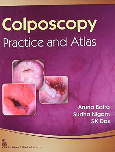 Colposcopy and Atlas: Practice and Atlas