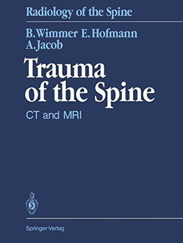 Trauma of the Spine. CT and MRI