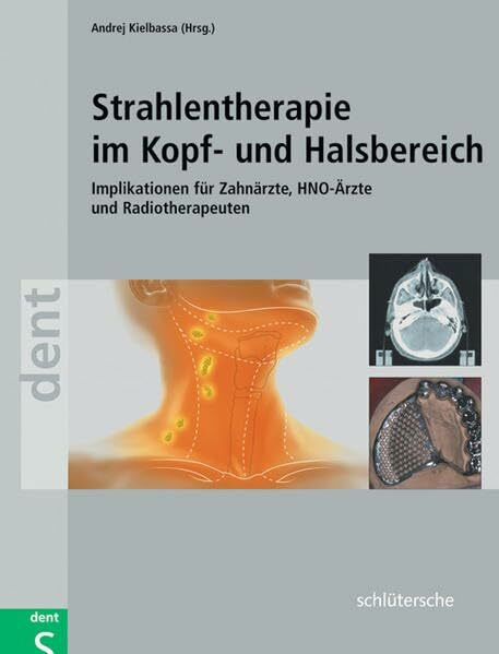 Strahlentherapie im Kopf- und Halsbereich: Implikationen für Zahnärzte, HNO-Ärzte und Radiotherapeuten