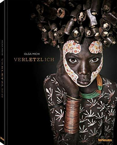 Verletzlich