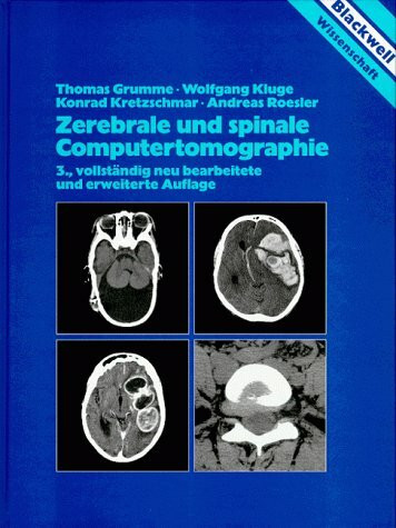 Zerebrale und spinale Computertomographie