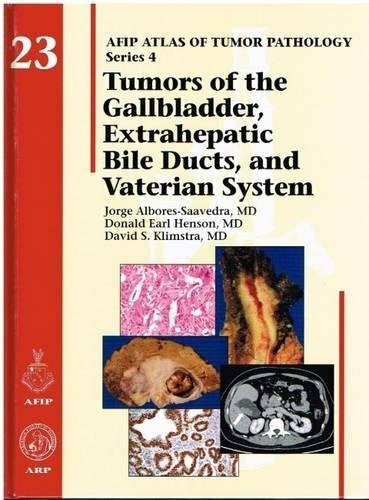 Tumors of the Gallbladers Extrahepatic Bile Ducts, and Vaterien System (Atlas of Tumor Pathology)
