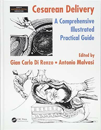 Cesarean Delivery: A Comprehensive Illustrated Practical Guide (Maternal-Fetal Medicine)