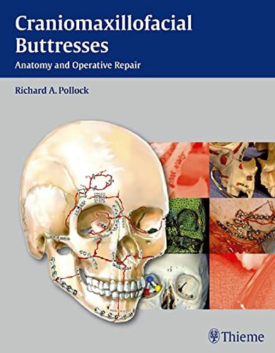 Craniomaxillofacial Buttresses: Anatomy and Operative Repair