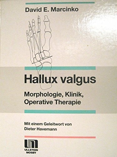 Hallux valgus