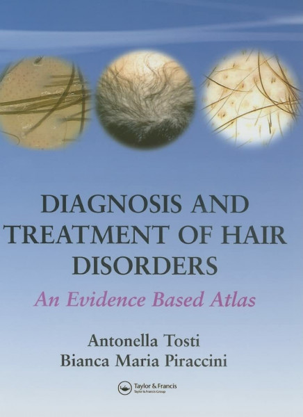 Diagnosis and Treatment of Hair Disorders: An Evidence-Based Atlas