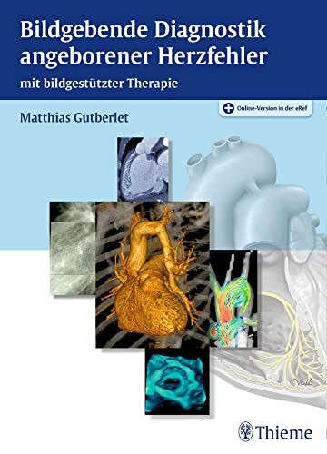 Bildgebende Diagnostik angeborener Herzfehler: mit bildgestützter Therapie