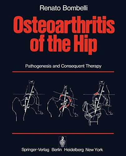 Osteoarthritis of the Hip: Pathogenesis and Consequent Therapy