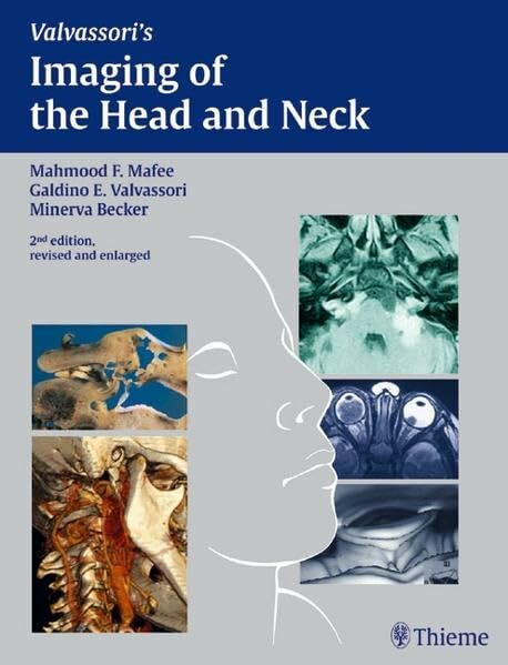 Imaging of the Head and Neck