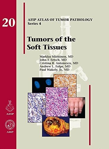 Tumors of the Soft Tissue (Atlas of Tumor Pathology, Band 4)