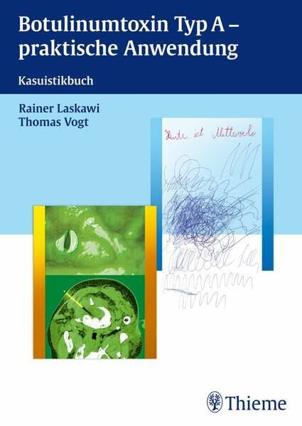 Botulinum Neurotoxin Typ A: Kasuistikbuch