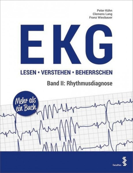 EKG lesen - verstehen - beherrschen