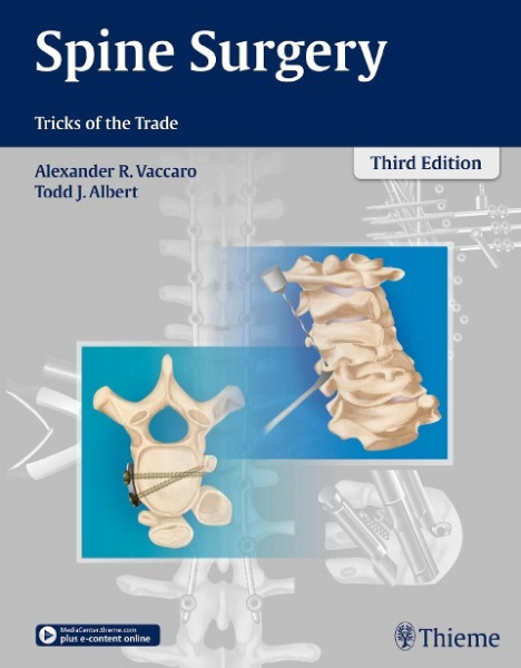 Spine Surgery: Tricks of the Trade