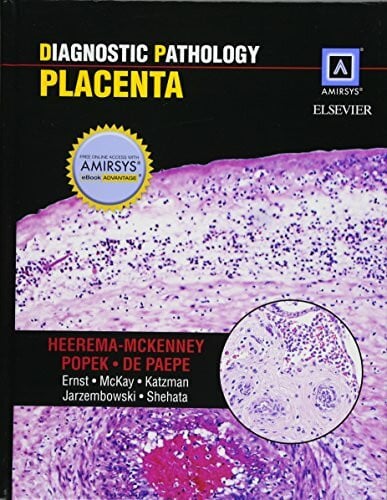 Diagnostic Pathology: Placenta