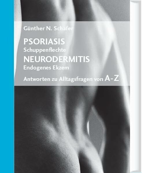 Psoriasis (Schuppenflechte) / Neurodermitis (Endogenes Ekzem) - Antworten zu Alltagsfragen von A-Z