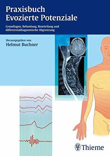 Praxisbuch Evozierte Potenziale: Grundlagen, Befundung, Beurteilung und differenzialdiagnostische Abgrenzung
