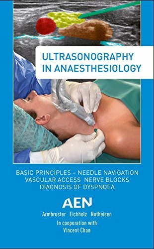 Ultrasonography in Anaesthesiology: Basic Principles - Needle Navigation, Vascular Access, Nerve Blocks, Diagnosis of Dyspnoea