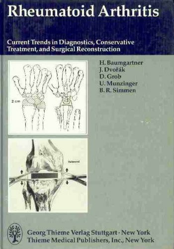Rheumatoid Arthritis: Current Trends in Diagnostic, Conservative Treatment, And Surgical Reconstruction