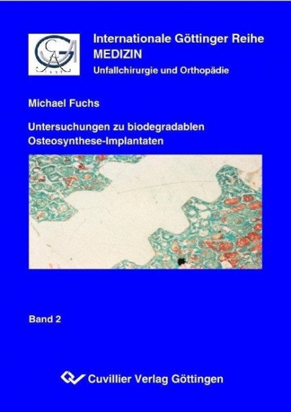 Untersuchungen zu biodegradablen Osteosynthese-Implantaten