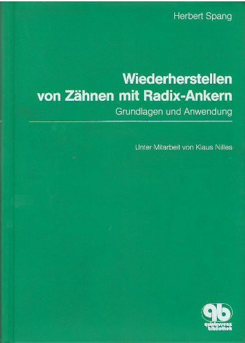 Wiederherstellen von Zähnen mit Radix-Ankern: Grundlagen und Anwendung