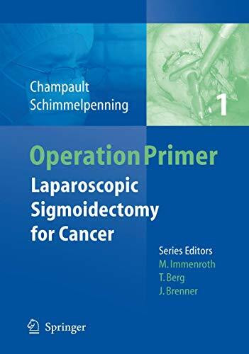 Laparoscopic Sigmoidectomy for Cancer (Operation Primers, Band 1)